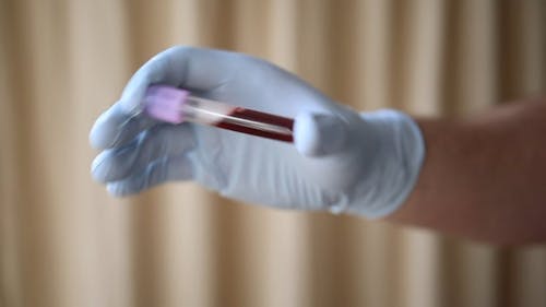 Blood Samples Placed In Specimen Tubes