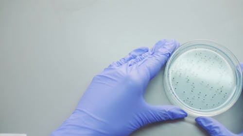 Person Carefully Holding A Container With Bacteria