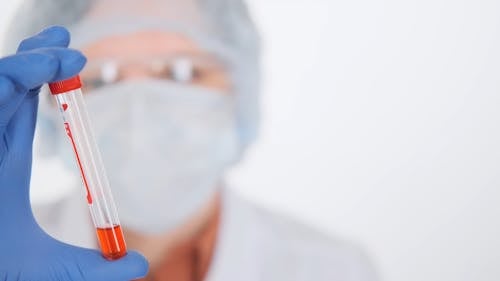 A Scientist Holding A Vacutainer Tubes With Sample