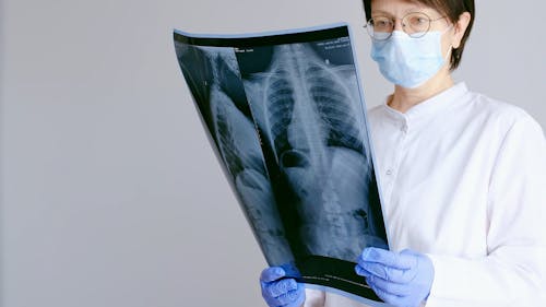 Female Doctor Looking at an X-Ray