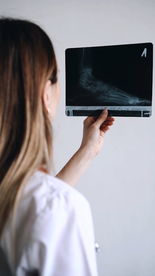 A Woman Checking an X-ray Film