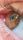 eyeball