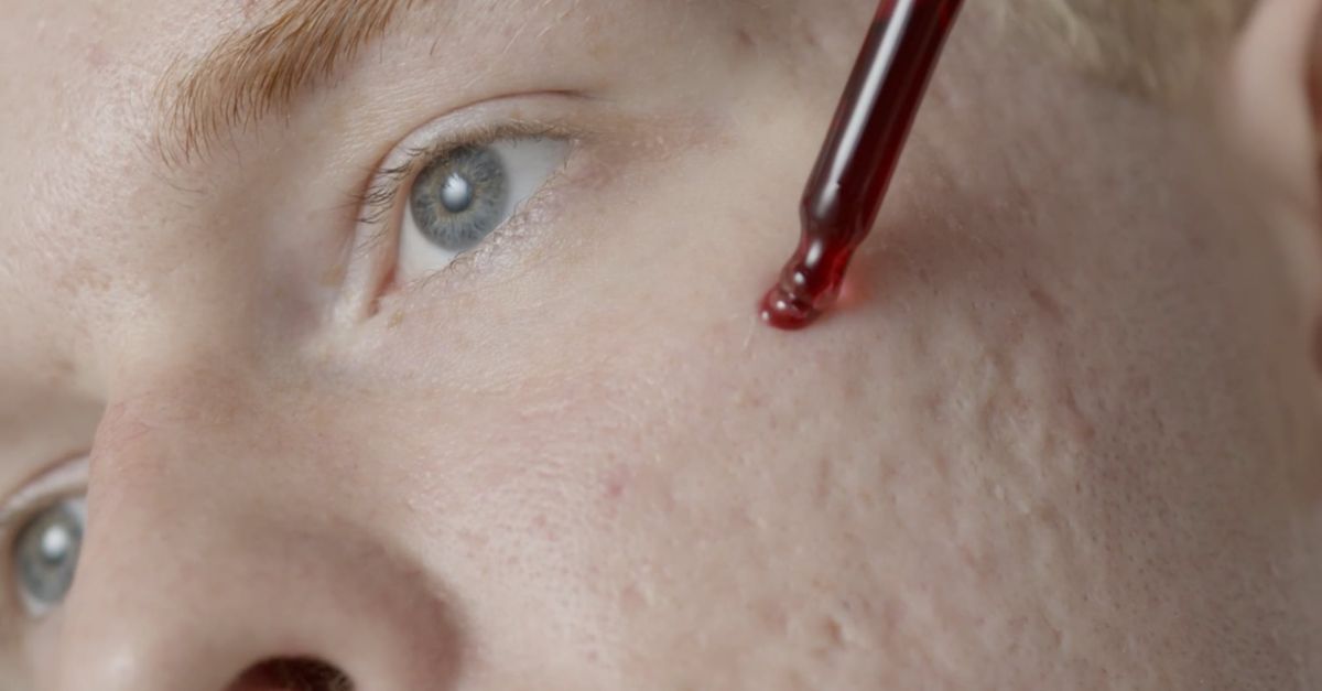 Liquid Using In Face A Man Applying Liquid Medicine On His Face Free Stock Video Footage ...