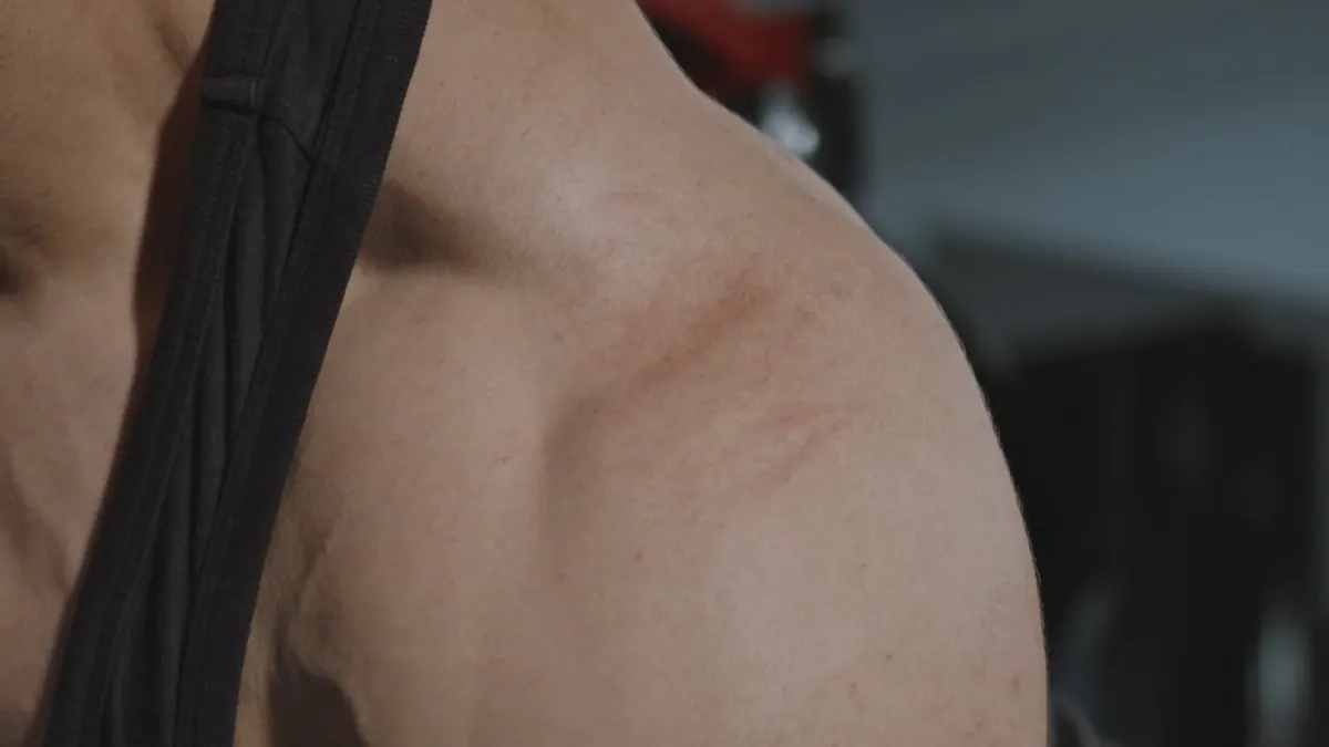 How to Care for Your Psoas Without Stretching