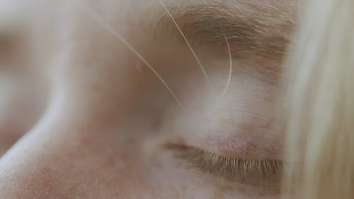 Close-Up Video of a Person's Eyes