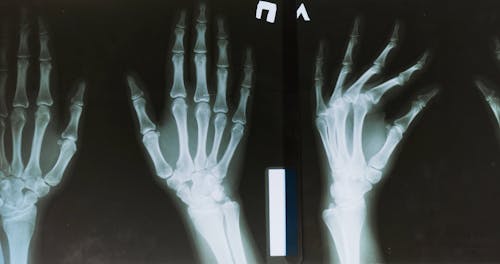 Presenting X Ray Images Free Stock Video presenting-x-ray-images-free-stock-video