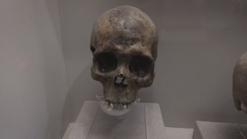 A Human Skull in Display
