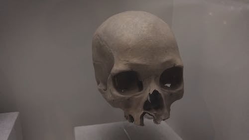 A Broken Skull on Display