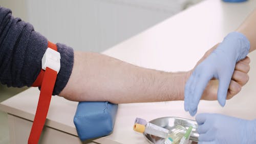 Close Up Shot of a Hand of a Man Getting Blood Test