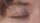 eye blink