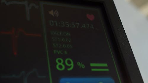 1,914 Vital Signs Monitor Stock Video Footage - 4K and HD Video Clips