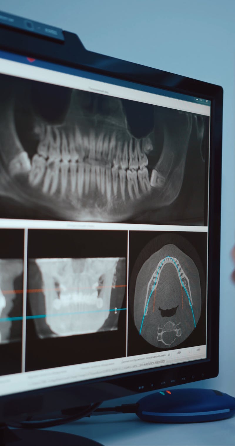 Jaw Videos, Download The BEST Free 4k Stock Video Footage & Jaw HD