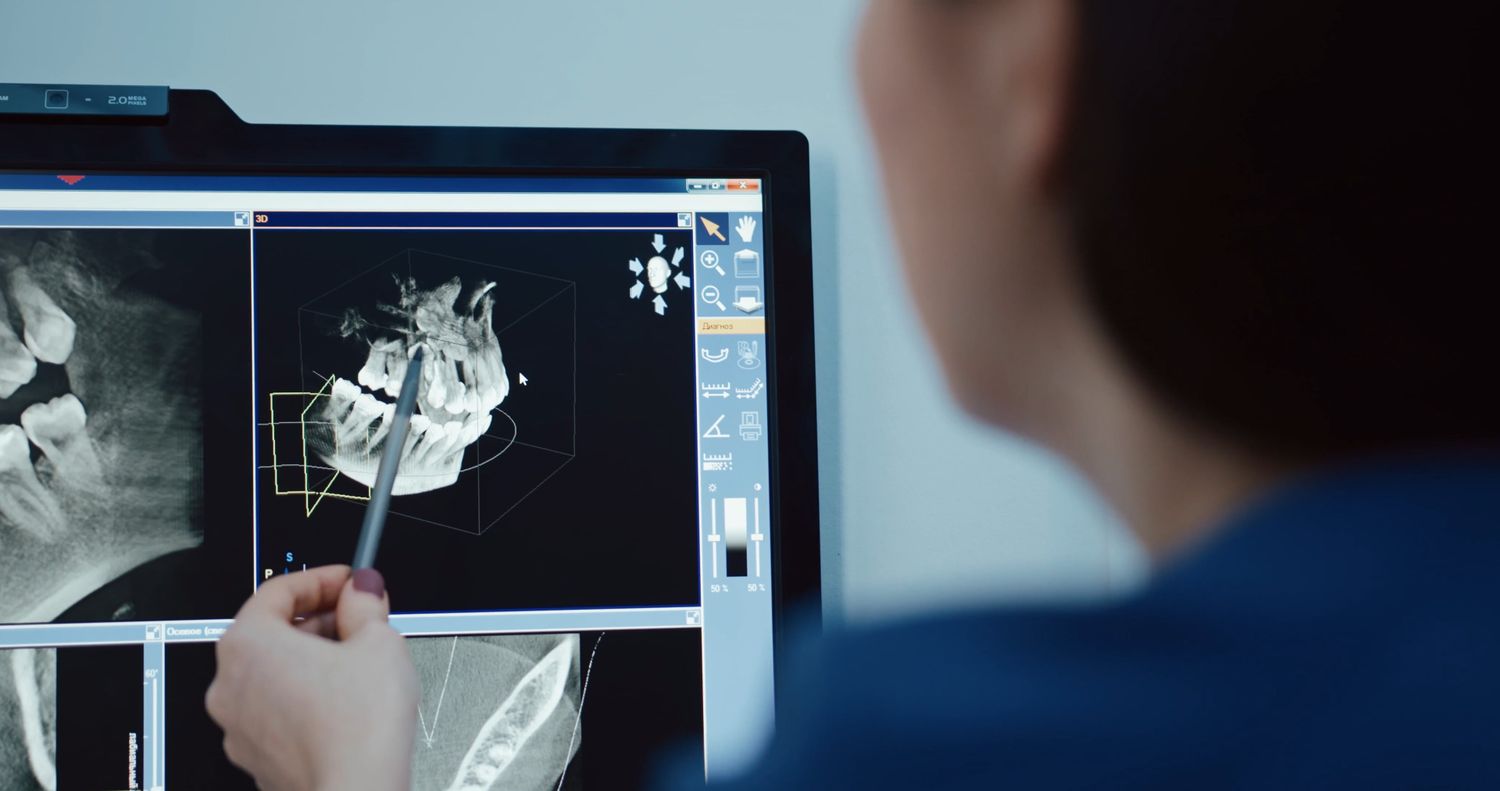 X Ray Analysis Videos, Download The BEST Free 4k Stock Video Footage ...