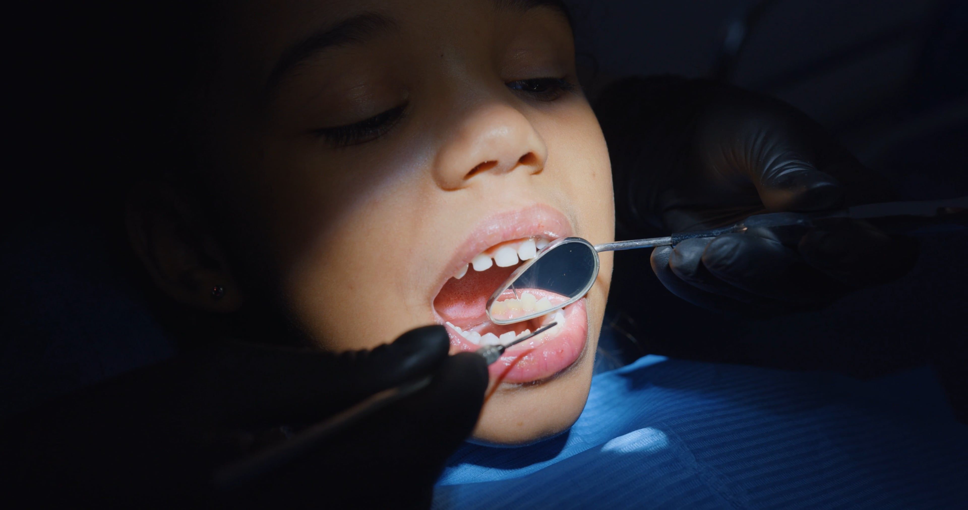 Video of a Dental Check-up Free Stock Video Footage, Royalty-Free 4K ...