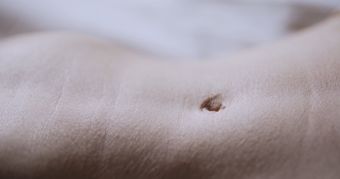 皱纹免费下载视频素材免费下载视频素材视频素材