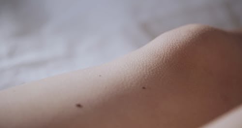 A Close-Up Video of a Person's Knee