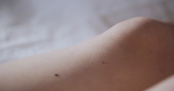 关节痛免费下载高清视频高清视频视频素材