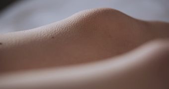 关节痛免费下载高清视频高清视频视频素材