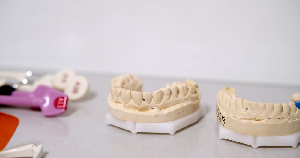 Flatlay Of Dental Casts And Instruments Free Stock Video flatlay-of-dental-casts-and-instruments-free-stock-video