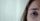 tired eyes