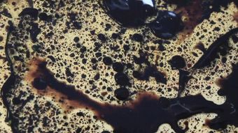 胎盘素视频素材