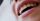 smile teeth