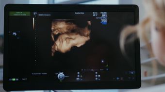 医疗高清视频视频素材高清视频视频素材