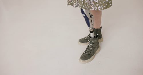 A Person with Left Prosthetic Leg