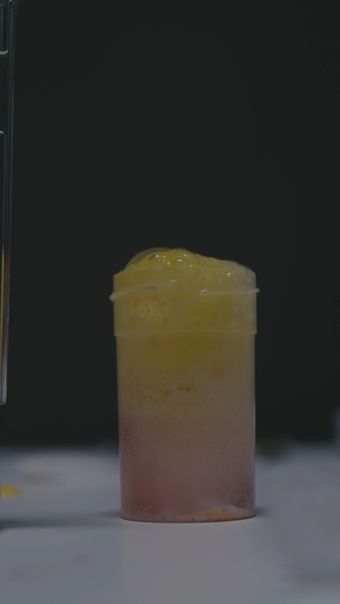 血液脂肪视频素材视频素材视频素材视频素材