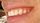 dental smile