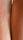 pigmentation