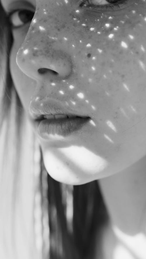 A Woman With Skin Freckles On Face