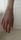joint pain