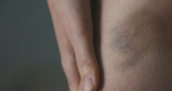 关节痛免费下载免费下载视频素材