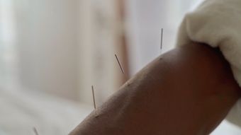 针灸视频素材
