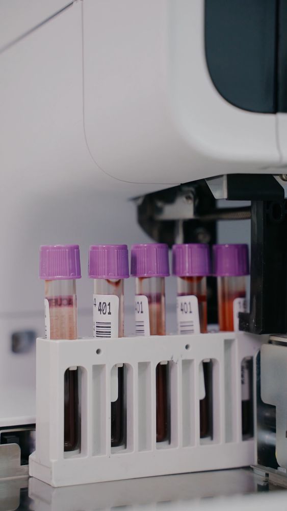 Lab Test Videos, Download The BEST Free 4k Stock Video Footage & Lab ...