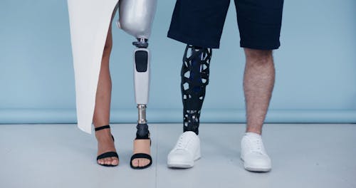 Man and Woman with Prosthetic Legs