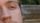 rubbing eyes