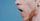 open mouth
