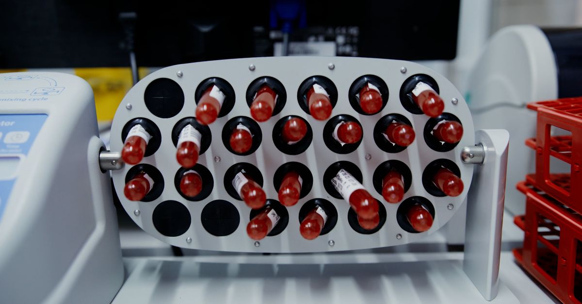 Test Tube Rotator Close up of a Test Tube Rotator Free Stock Video Footage, Royalty-Free ...