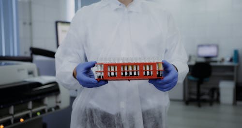 A Person Holding a Test Tube Rack in a Laboratory